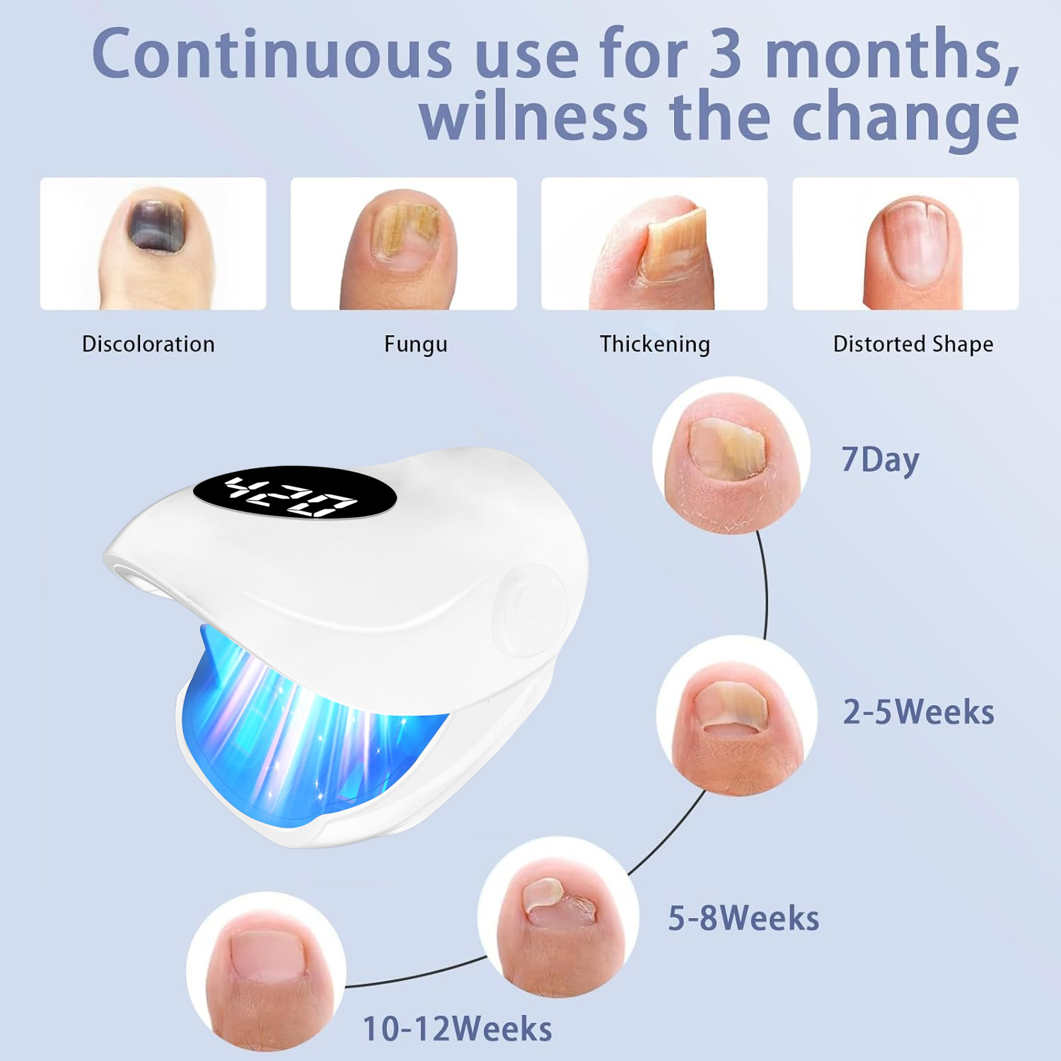 USB Charging Nail Fungus Treat - Galvanic Skin Sensor ulasan dan harga